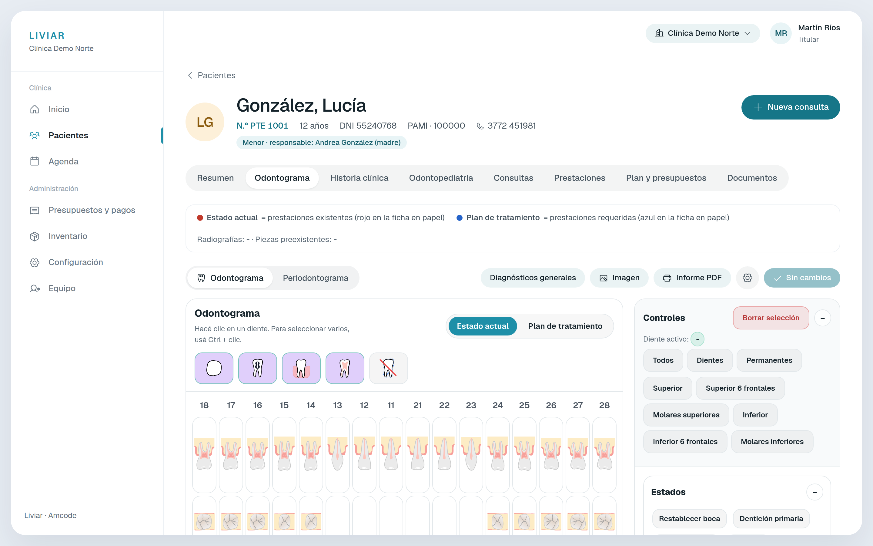 Odontograma de un paciente en Liviar